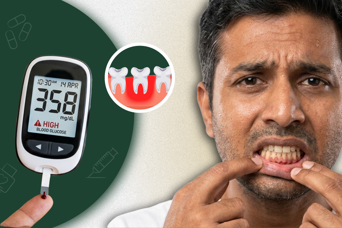 How Gum Disease Can Worsen Diabetes, Heart Disease, and More